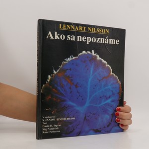 náhled knihy - Ako sa nepoznáme : objavná cesta s fotografickým aparátom do nášho tela
